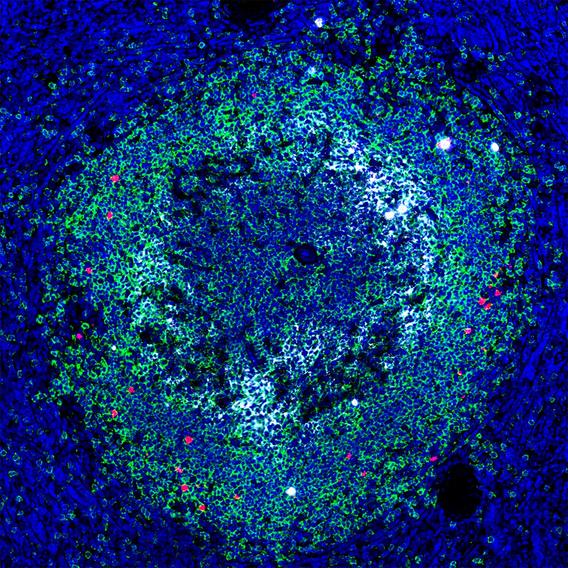 RNAscope image lymphoid follicle